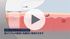 フォトフェイシャル&reg;紹介動画